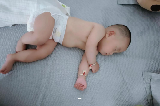 乐陵宝宝脸上有白色斑块